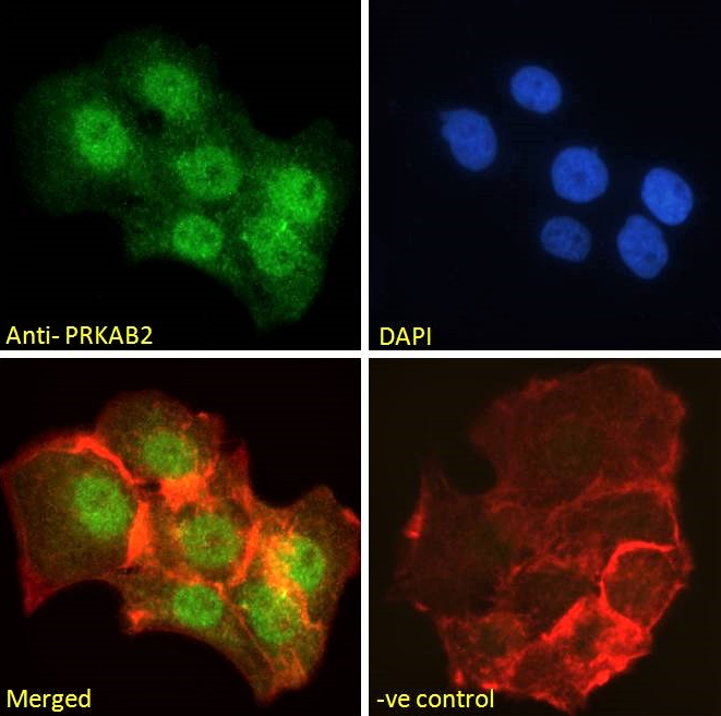 Goat anti-PRKAB2 Antibody