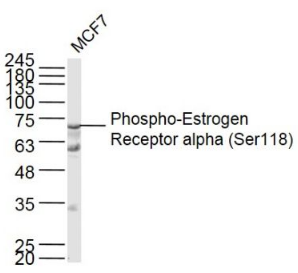 Estrogen Receptor alpha (phospho-Ser118) antibody