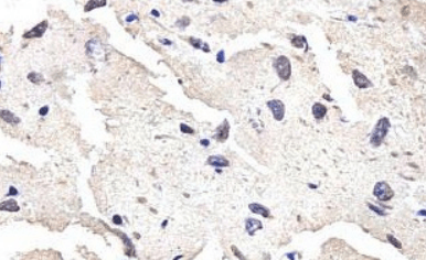 PLEKHG3 Antibody