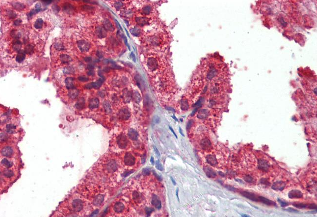 Goat anti-Restin / CLIP1 Antibody