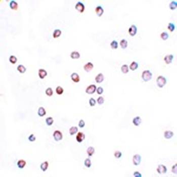 SCUBE2 Rabbit Polyclonal Antibody