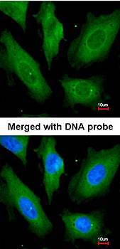 SCY1 like 3 antibody