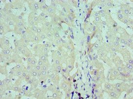 SDC1 antibody