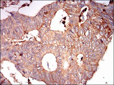 SDC1 Antibody