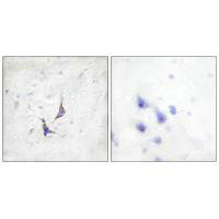 SDC4 (Ab-179) Antibody
