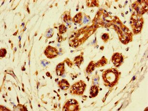 SDCBP2 Antibody