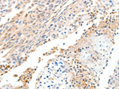 CXCL12 Antibody