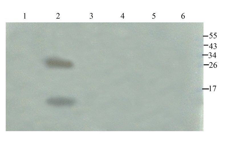 SDF1 antibody