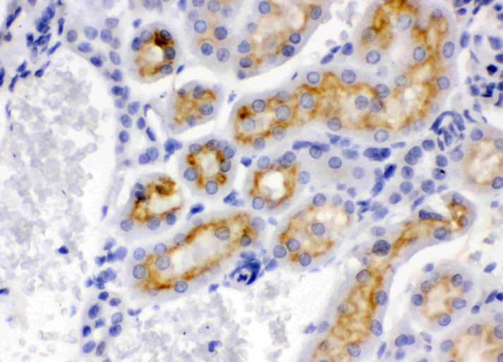CYP24A1 Antibody
