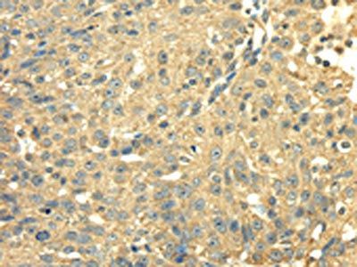 SDHA Antibody