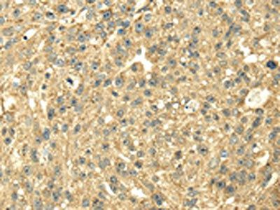 SDHA Antibody