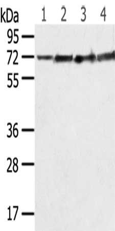 SDHA Antibody