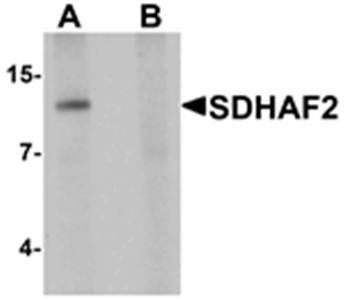 SDHAF2 Rabbit Polyclonal Antibody