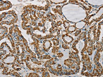 SDHB Antibody