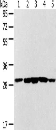 SDHB Antibody