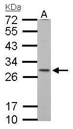 SDHB antibody
