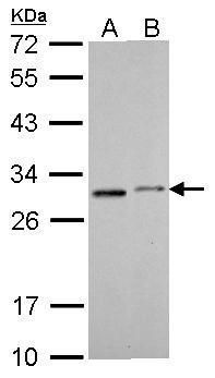 SDHB antibody