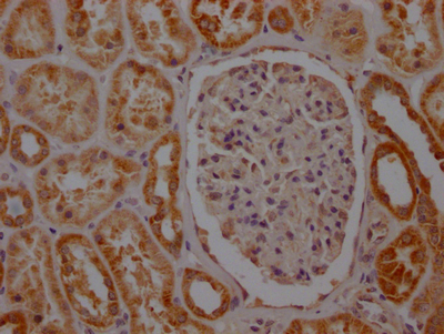 SDHB Recombinant Monoclonal Antibody