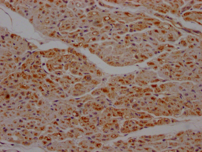 SDHB Recombinant Monoclonal Antibody