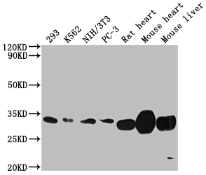 SDHB Recombinant Monoclonal Antibody