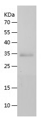 Recombinant Human IgE