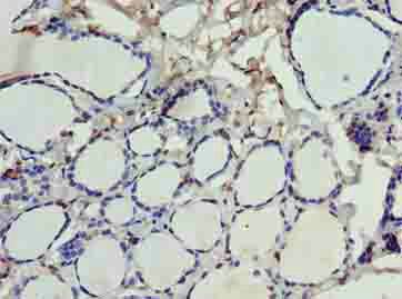 SDSL Antibody