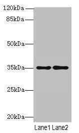 SDSL antibody