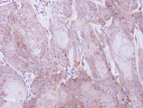 SEC61A1 antibody