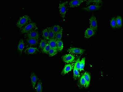 Secretory carrier-associated protein 3 antibody
