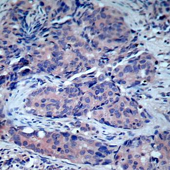 SEK1/MKK4 (Ab-261) Antibody
