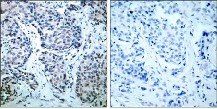 SEK1/MKK4 (Phospho-Thr261) Antibody