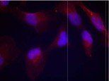 SEK1/MKK4 (Phospho-Thr261) Antibody