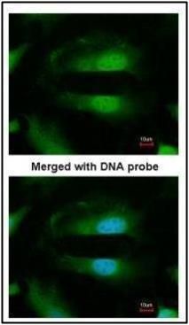 Selenophosphate synthetase 1 antibody