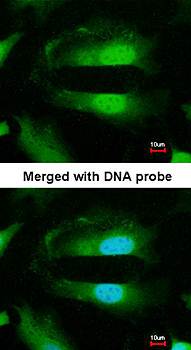Selenophosphate synthetase 1 antibody