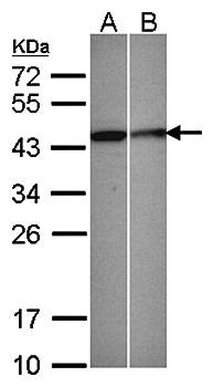 Selenophosphate synthetase 1 antibody