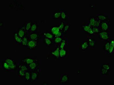 Selenoprotein P antibody