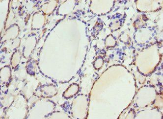 SELENOP Antibody