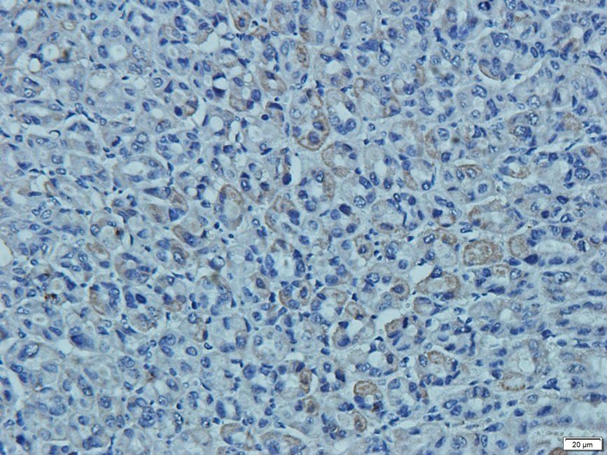 SEMA3A antibody
