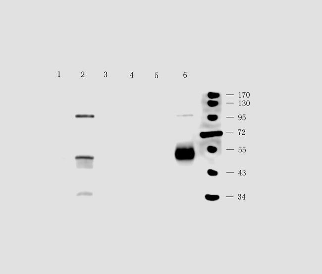 SEMA3A antibody