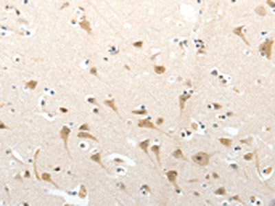 SEMA3D Antibody