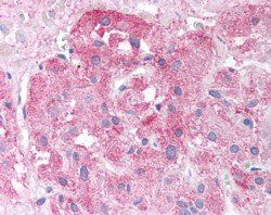 Goat anti-SEMA3E Antibody