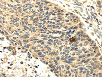 SEMA4F Antibody
