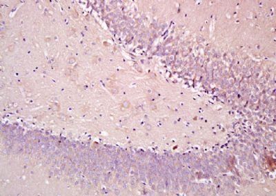 SEMA4F Rabbit Polyclonal Antibody