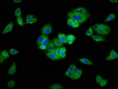 SEMA5A antibody