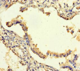 SEMA5A Antibody