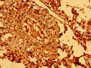 SEMA5B Antibody