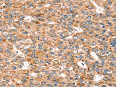 SEMA7A Antibody