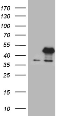 Semaphorin 4D Antibody