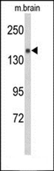 Semaphorin 5A antibody