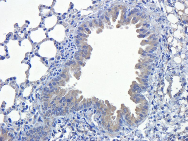 SEMA3A antibody